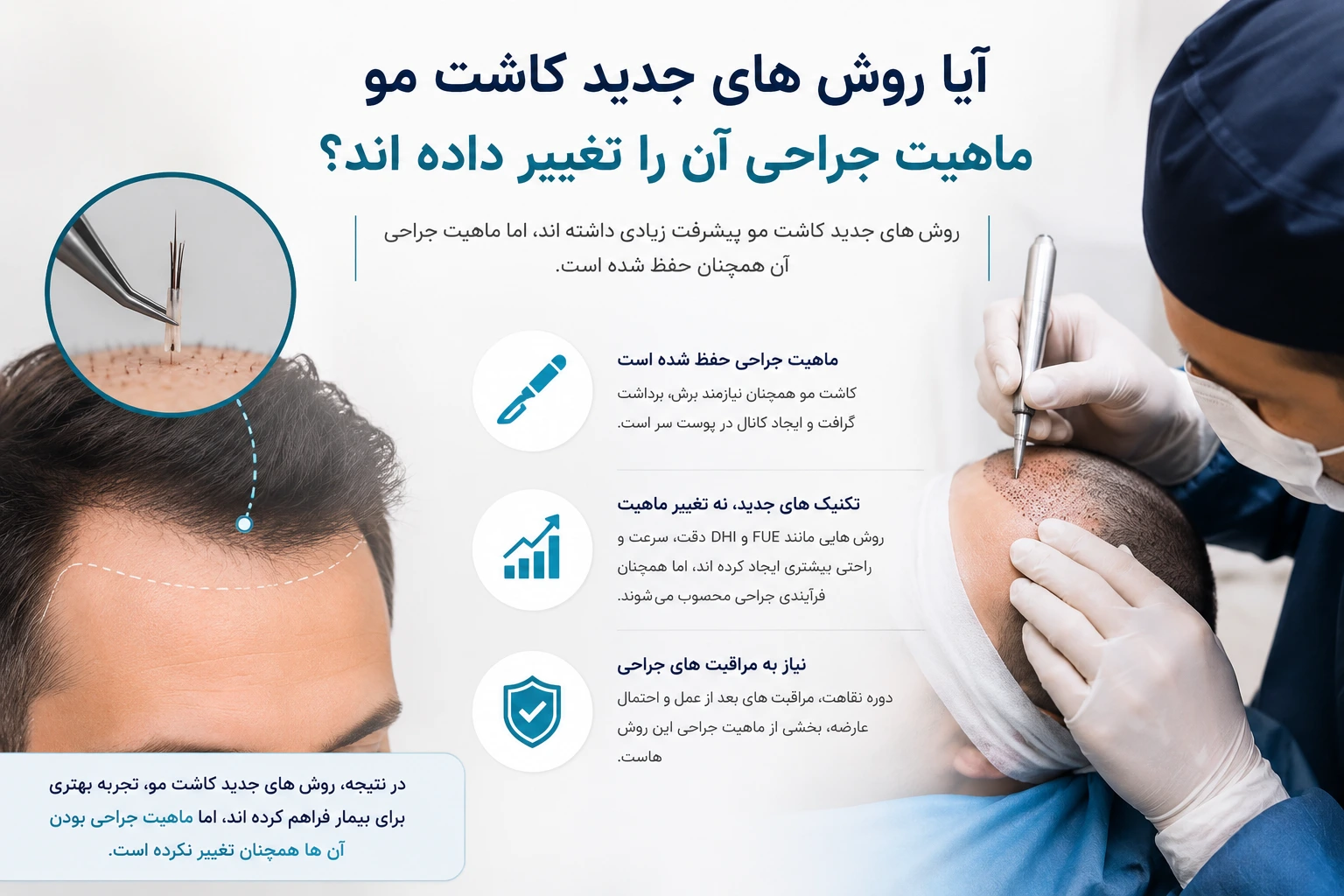 کاشت مو بدون درد و جراحی! دروغی تبلیغاتی برای جذب مشتری آیا روش های جدید کاشت مو ماهیت جراحی آن را تغییر داده اند؟